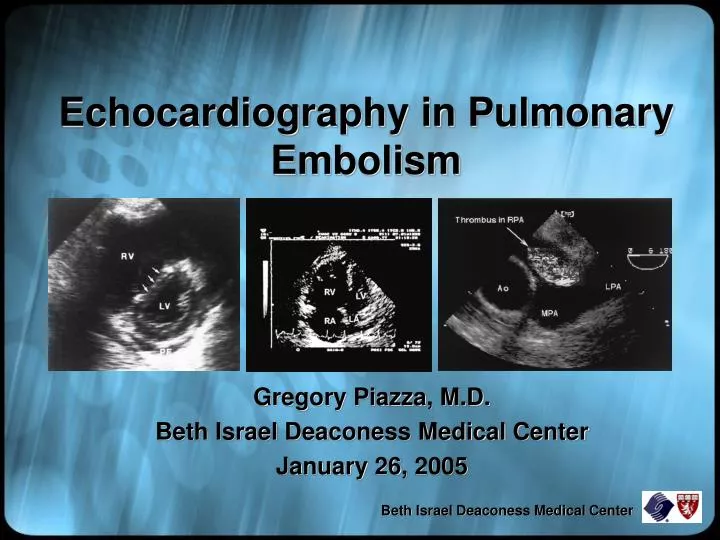 echocardiography in pulmonary embolism