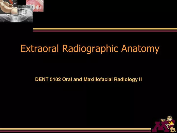 extraoral radiographic anatomy