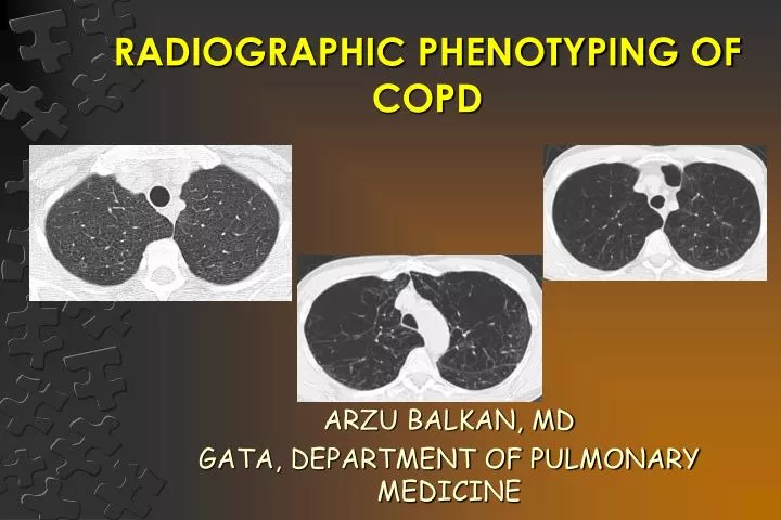 radiographic phenotyping of copd