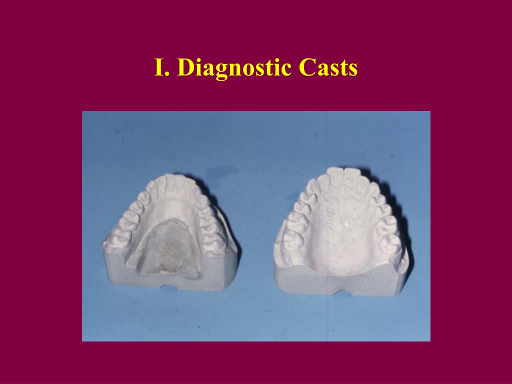PPT - I. Diagnostic Casts PowerPoint Presentation, free download - ID ...