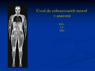 Úvod do zobrazovacích metod v anatomii RTG CT MRI