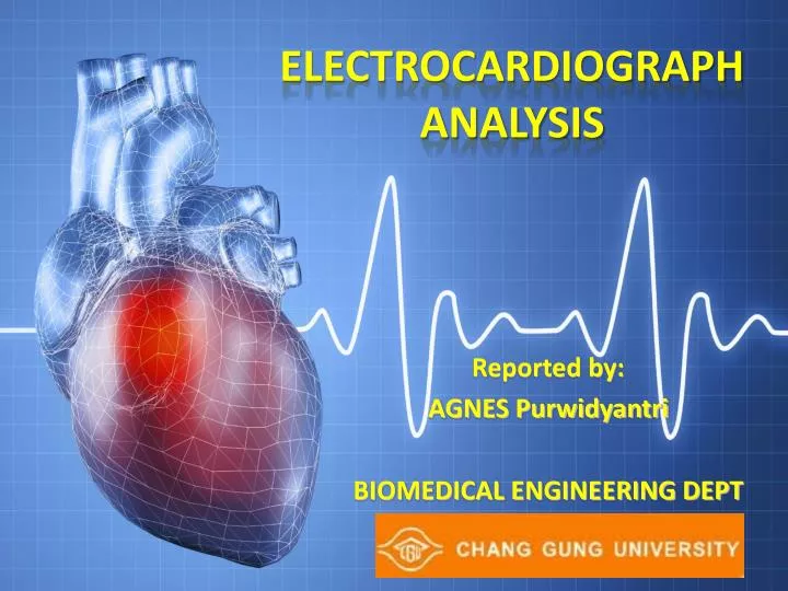 electrocardiograph analysis