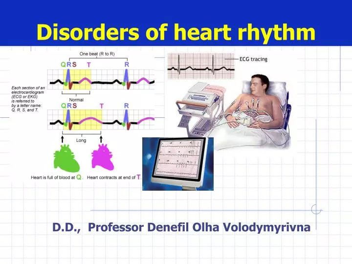 disorders of heart rhythm