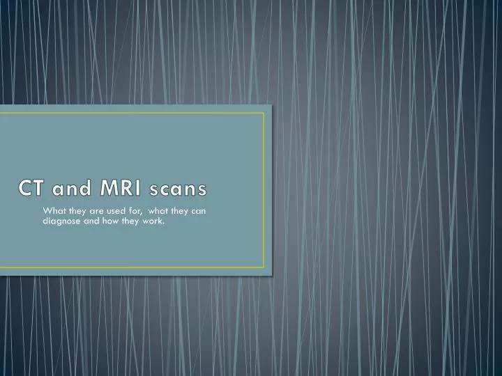 ct and mri scans