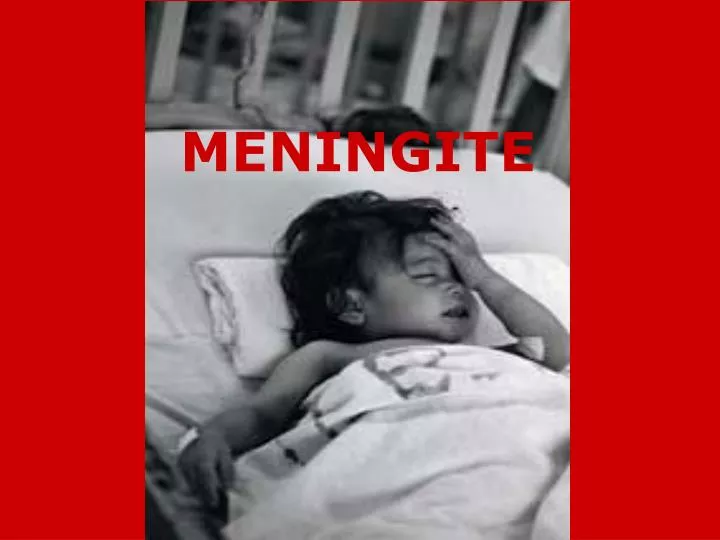 meningite