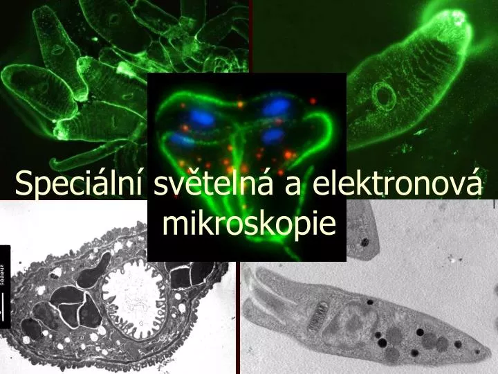 speci ln sv teln a elektronov mikroskopie