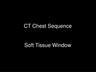 CT Chest Sequence Soft Tissue Window