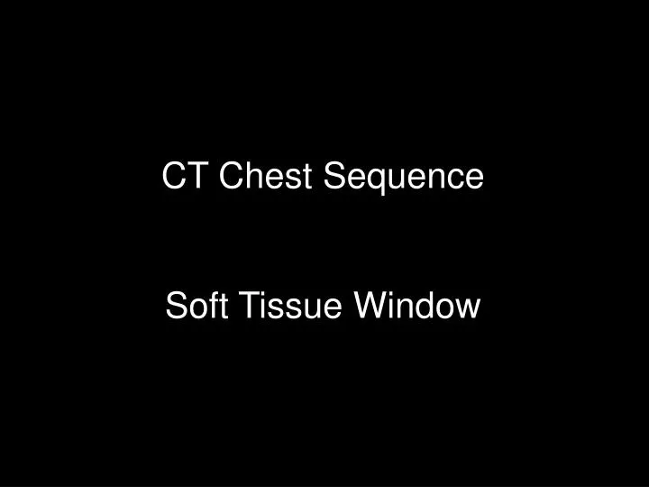 ct chest sequence soft tissue window