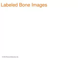 Labeled Bone Images