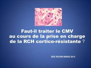 Faut-il traiter le CMV au cours de la prise en charge de la RCH cortico-résistante ?
