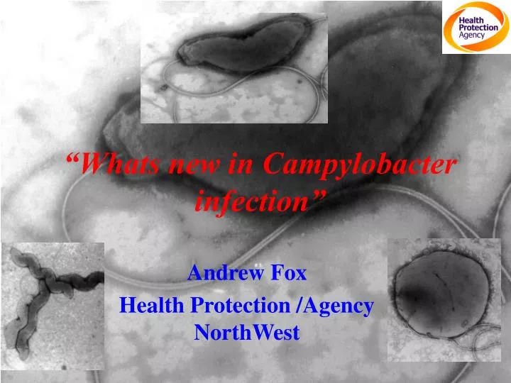 whats new in campylobacter infection