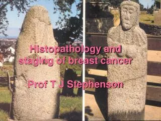 Histopathology and staging of breast cancer Prof T J Stephenson