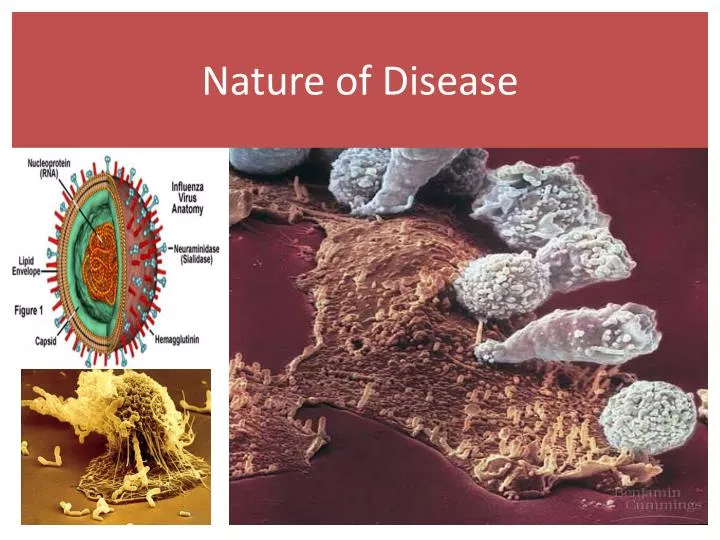 nature of disease