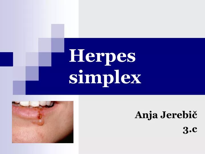 herpes simplex