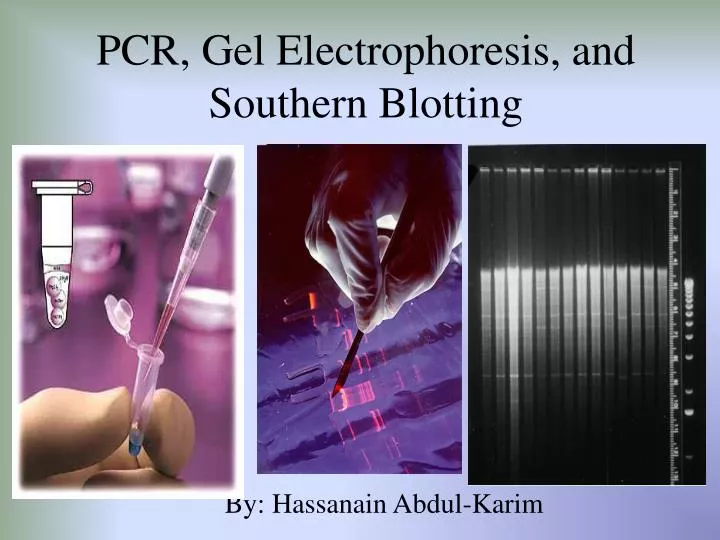 pcr gel electrophoresis and southern blotting