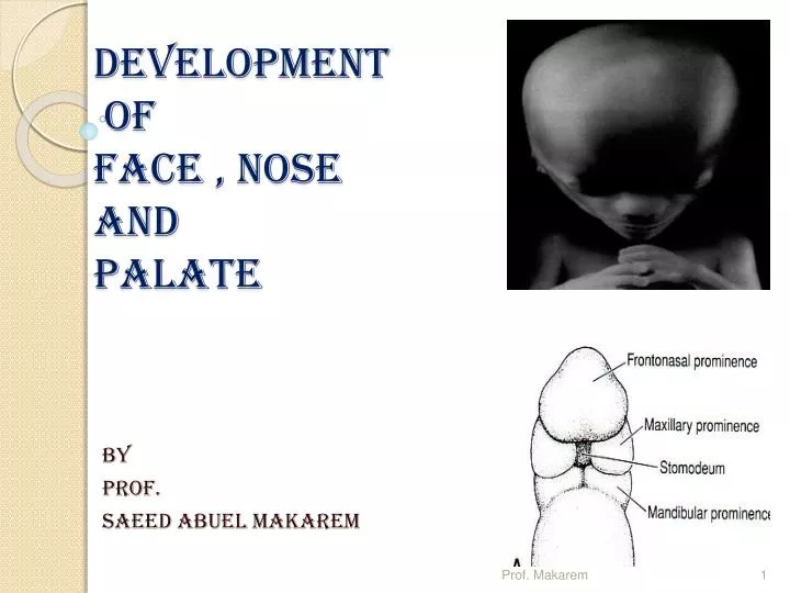 development of face nose and palate