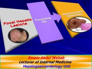 Essam Abdul Wahab Lecturer of Internal Medicine Hepatogastroenterlogy Unit