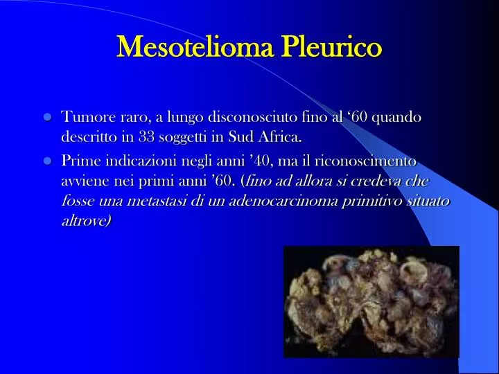 mesotelioma pleurico