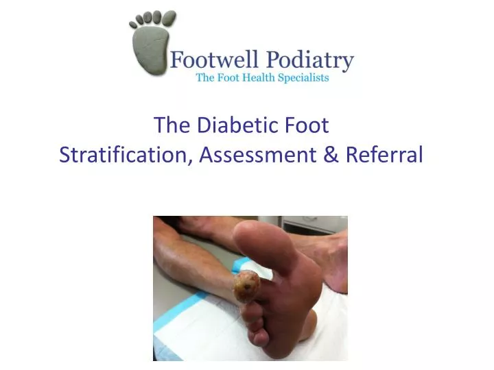 the diabetic foot stratification assessment referral