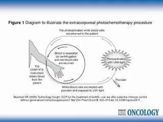 Figure 1 Diagram to illustrate the extracorporeal photochemotherapy procedure