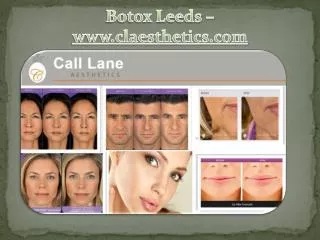 Botox Leeds -www.claesthetics.com