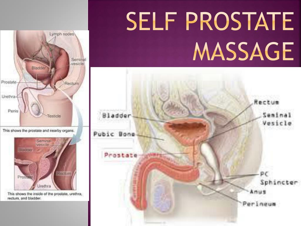 PPT - Self Prostate Massage PowerPoint Presentation, free download - ID