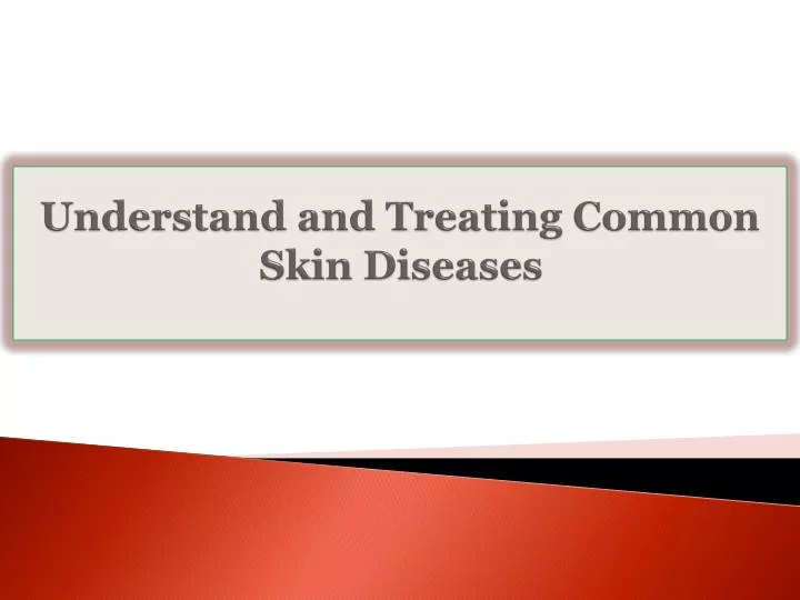 understand and treating common skin diseases