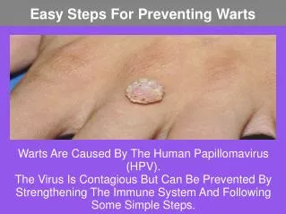 Easy Steps For Preventing Warts