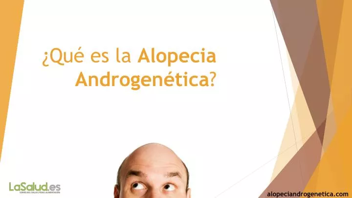 qu es la alopecia androgen tica