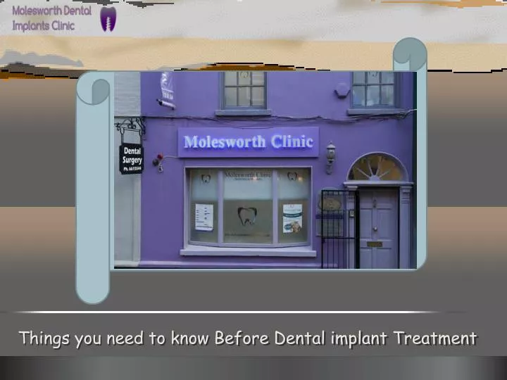 things you need to know before d ental implant treatment