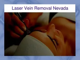 Laser Vein Removal Nevada