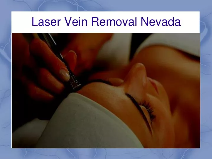 laser vein removal nevada