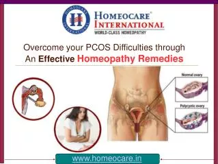 Cure from PCOS Difficulties with an Alternative Homeopathy A