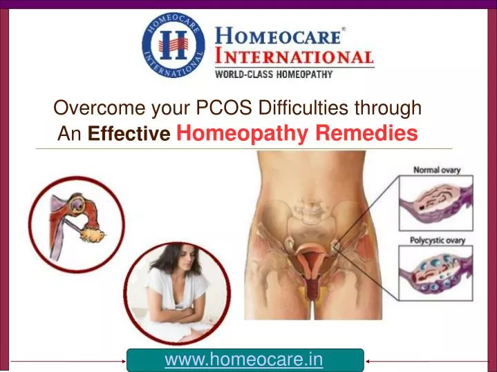 overcome your pcos difficulties through an effective homeopathy remedies