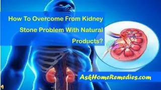 How To Overcome From Kidney Stone Problem With Natural Produ