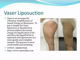 Vaser Liposelection | cosmetic surgeon