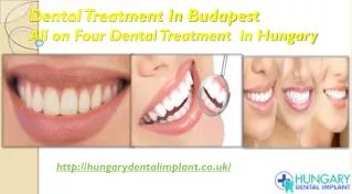 Dental Treatment In Budapest - All on Four Dental Treatment