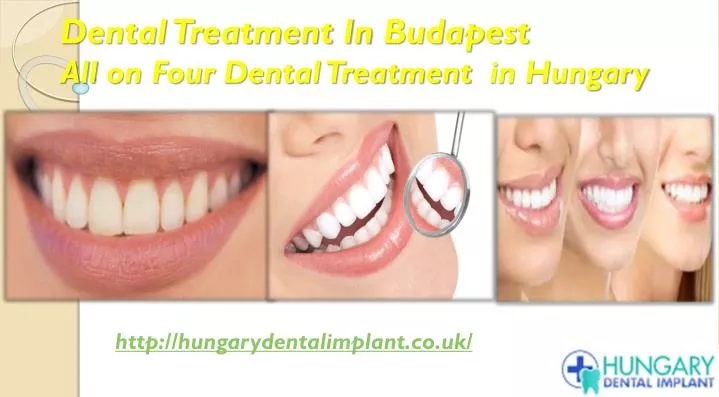 dental treatment in budapest all on four dental treatment in hungary