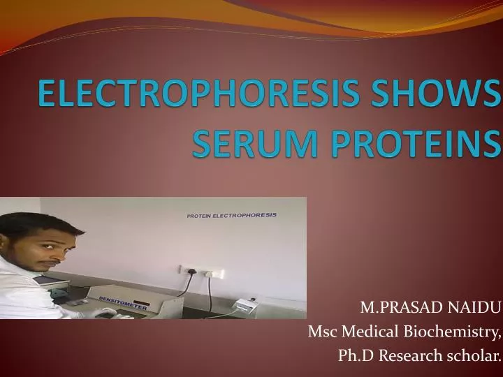 electrophoresis shows serum proteins