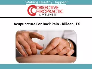 Acupuncture For Back Pain In Killeen, TX