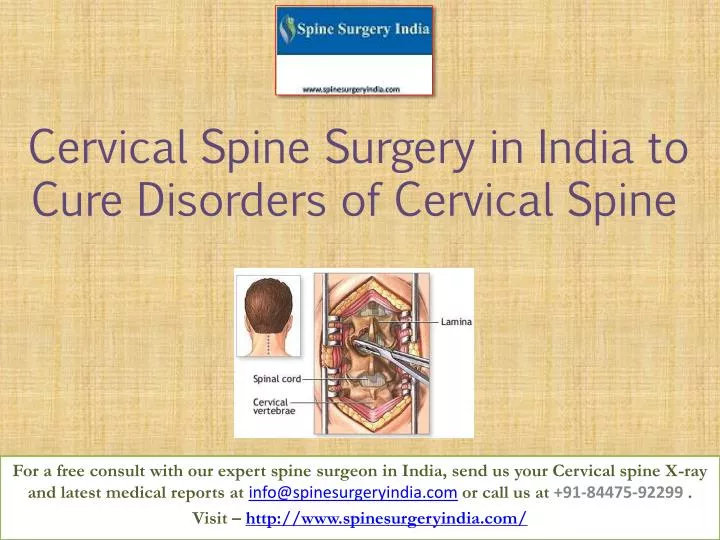 cervical spine surgery in india to cure disorders of cervical spine